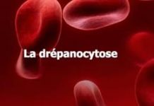 La drépanocytose :Une maladie invisible qui tue à petit feu